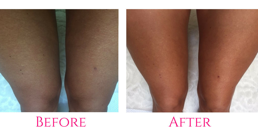 Crepe Erase™ Skincare Review Cremes Come True